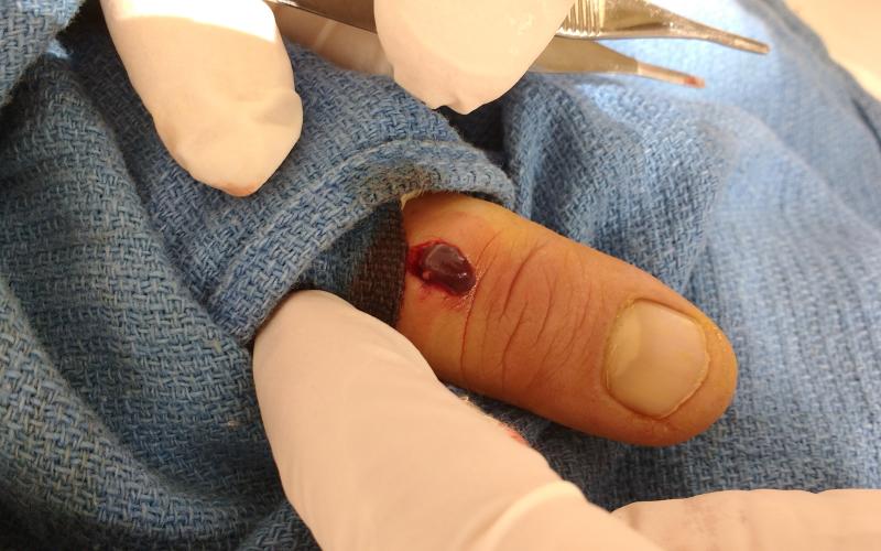 The Return of Gross Medical Pictures!! Hooray!!
